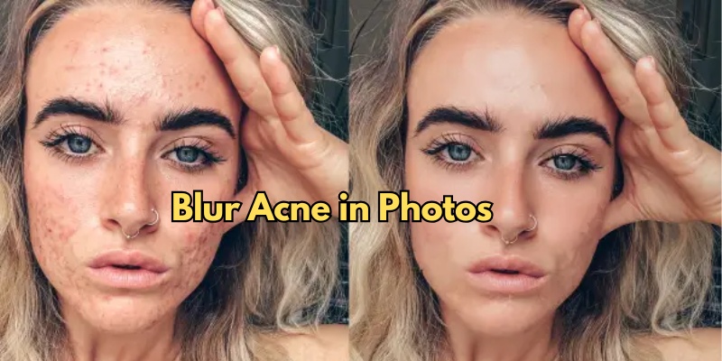 acne blurr photo