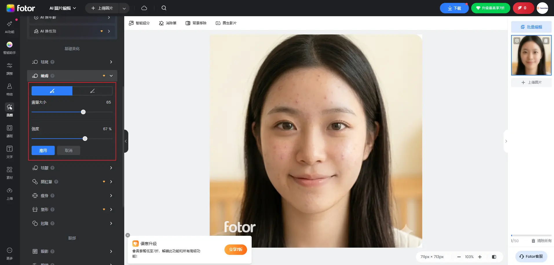 Fotor Magic Erase 工具點擊祛痘痘疤效果展示